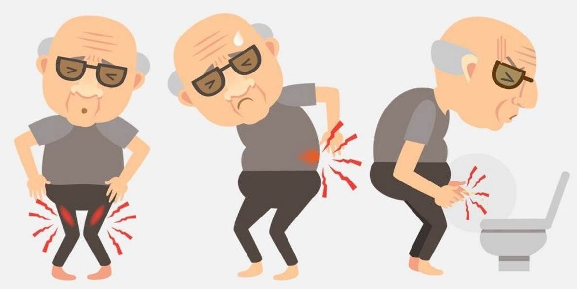 Συμπτώματα προστατίτιδας